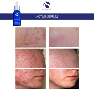 IS Clinical Active Serum